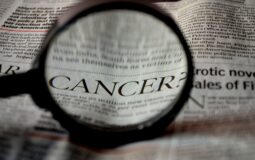 Prevenirea cancerului: sfaturi utile și informații importante